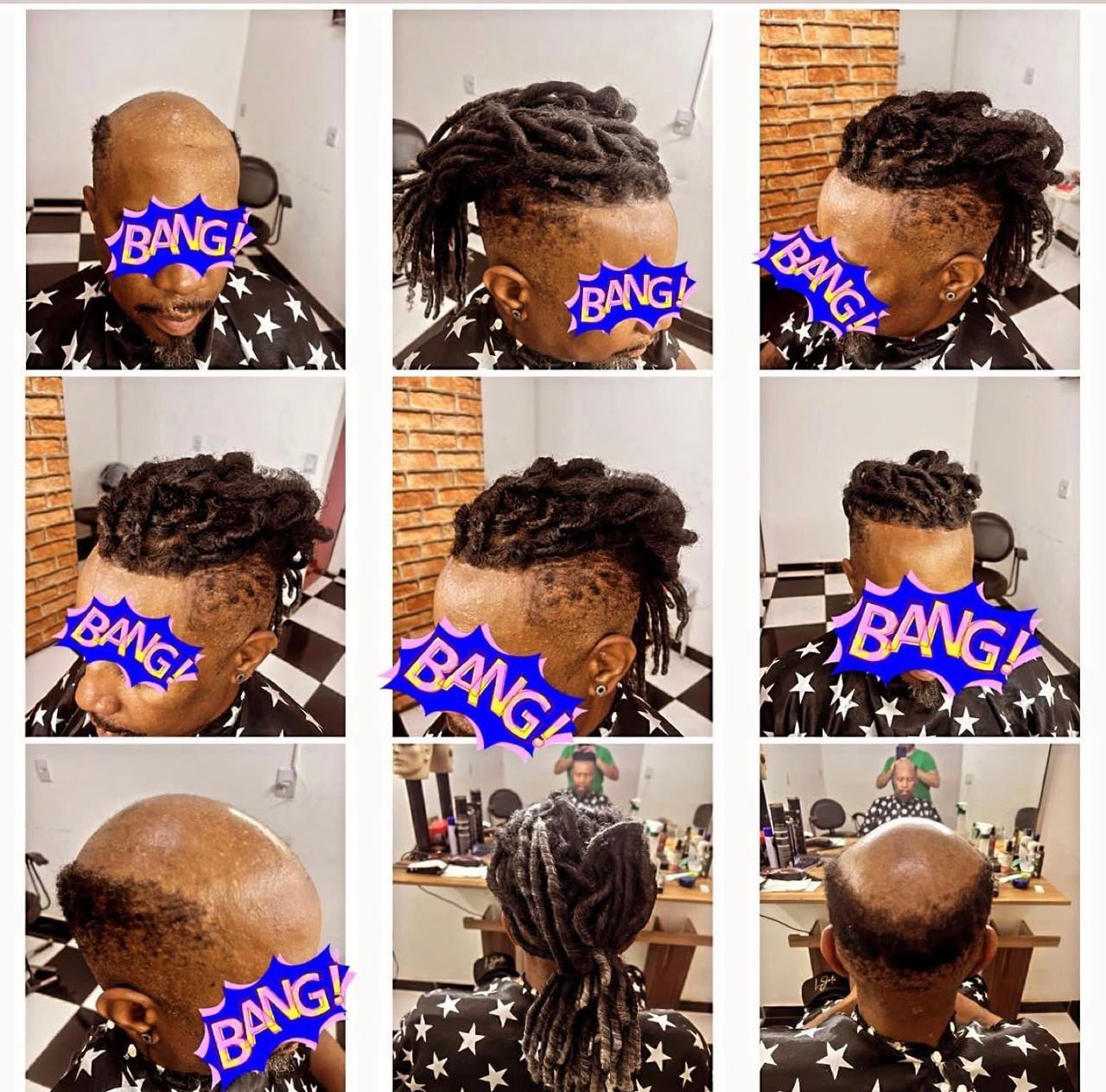 Antes e depois de prótese capilar masculina com estilo de cabelo em dreadlocks